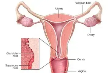 cervical-the-clutter