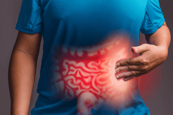colon cancer -the clutter